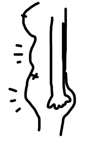 妊娠って胃も出ますか？画あり