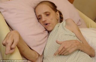ビールだけしか飲まなかった女性、かなりえずき、やせたかなしい姿に