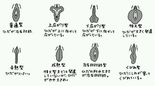 ビラビラの整形手術した人いる？