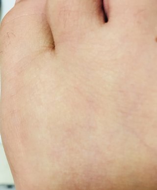 私ほど毛深い女はいない