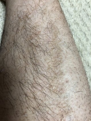 私ほど毛深い女はいない