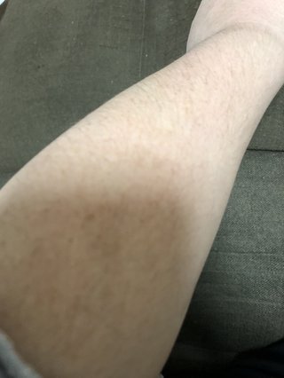 私ほど毛深い女はいない