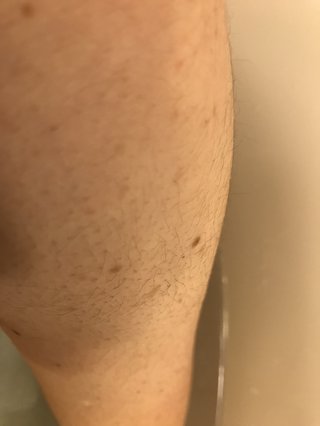 私ほど毛深い女はいない