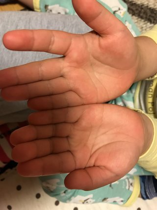 ますかけ線