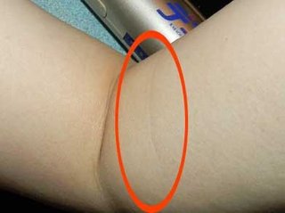 腕に線ある人いる？ちょっと集まって