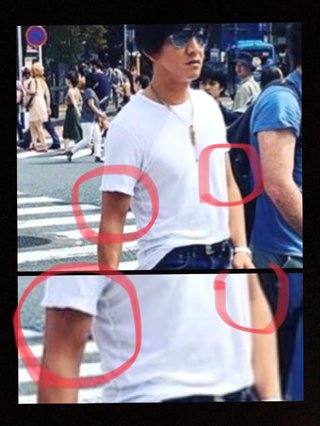 木村拓哉に遭遇。腕が紫に腫れてる