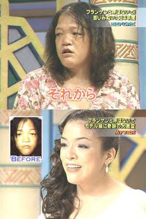 昔ビューティコロシアムで