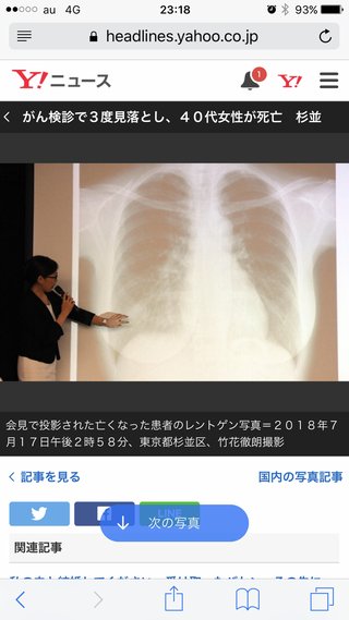 ガン検診 3度見落とされ40代女性死亡