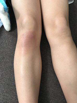 お医者さんか、看護師さん または詳しい方