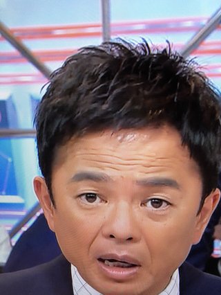 恵俊彰、増毛したでしょ？w