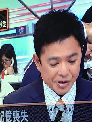 恵俊彰、増毛したでしょ？w