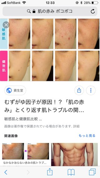 敏感肌の人