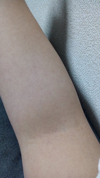 看護師さん教えて！