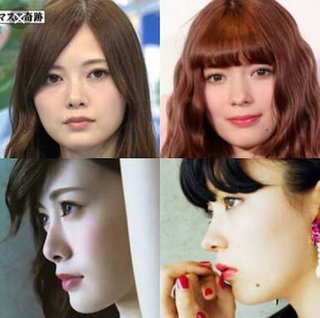 カワハギじゃないけど横顔が残念な芸能人は？
