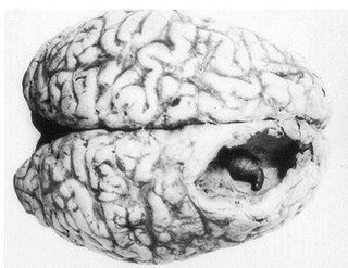 キムチの危険性について 朝鮮日報東京