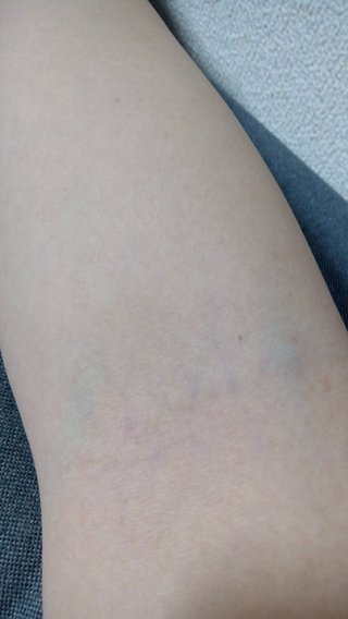 看護師さん教えて！