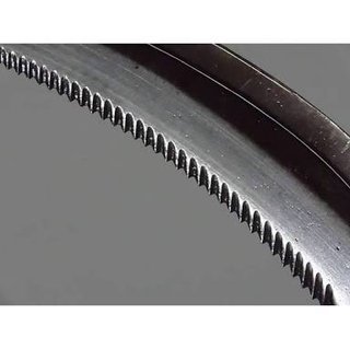 女子児童。稲刈りの授業中に鎌で小指を切断