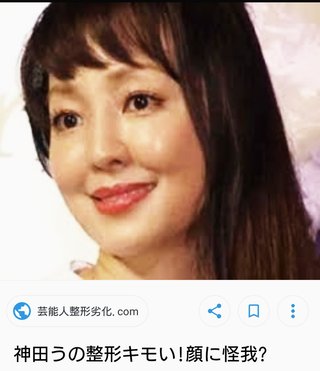 神田うの(43)が本人の整形疑惑を否定