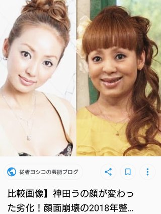 神田うの(43)が本人の整形疑惑を否定