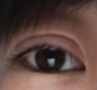 1時間前整形したよ。みてみてー！