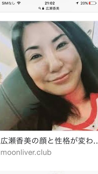 広瀬香美って整形失敗したの？