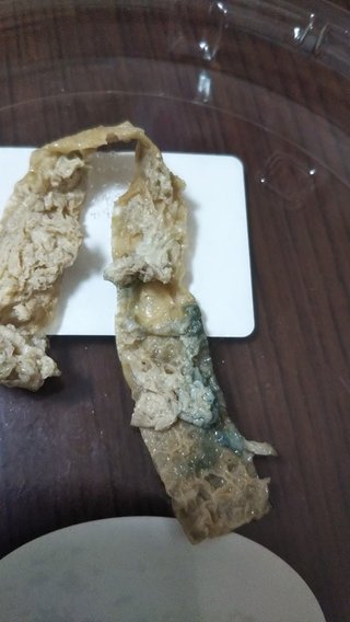 これってカビですか?