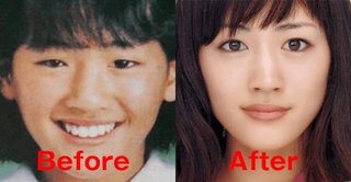 綾瀬はるかって骨太でゴツいのに美人扱い