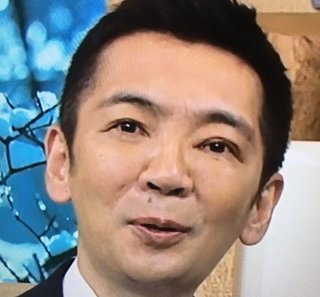 宮根誠司さん、整形に失敗ｗｗｗ