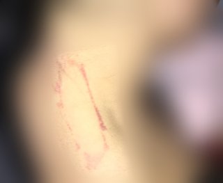 旦那にやられたんだけど