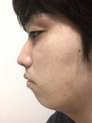俺の横顔って言うほど酷いか？？？