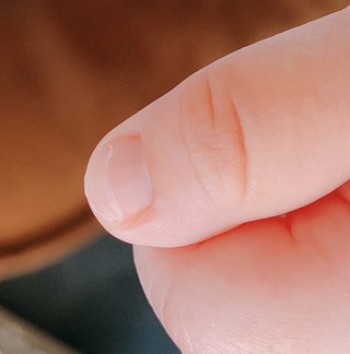 生後2ヶ月で爪が割れています(；＿；)