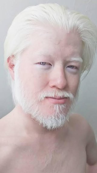 アルビノ可愛い