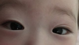 １歳3ヶ月で寝起きだけ二重は二重になる？