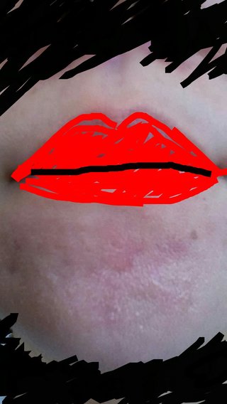 美容皮膚科、詳しい人教えて