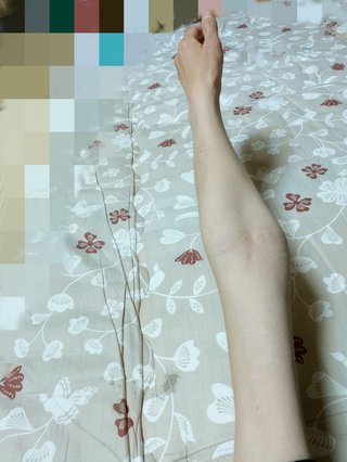 二の腕を太くするには