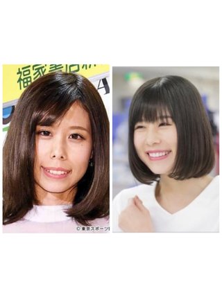 有村藍里　整形手術に要した費用は約４００万円！上あごと下あごを切りはずした