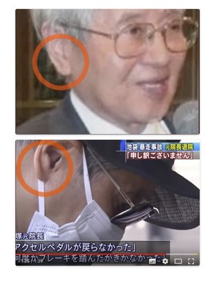 池袋で乗用車とごみ収集車が衝突　女性と子供が意識不明　10人けが