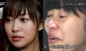 芸能界の整形モンスターNo.1