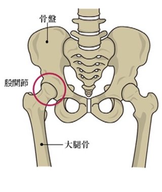 股関節が痛い場合どこへ行けばいいですか