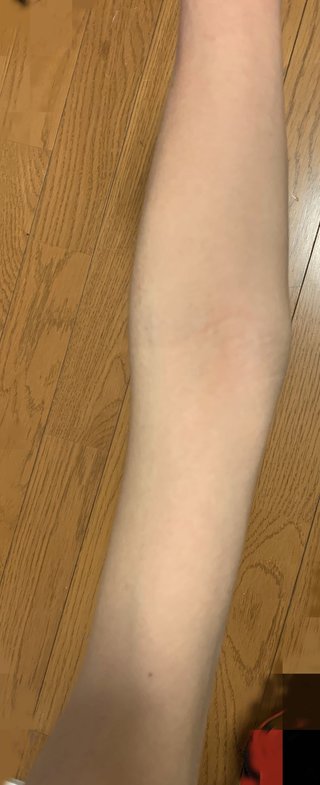 二の腕を太くするには