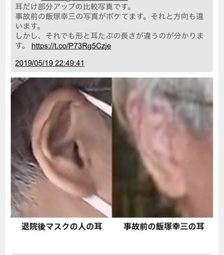 池袋で乗用車とごみ収集車が衝突　女性と子供が意識不明　10人けが