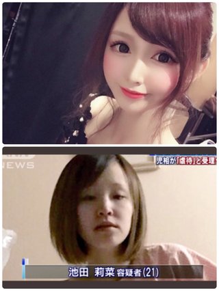2歳の娘死亡　傷害容疑で母親(21)と交際相手(24)逮捕　体には複数のけが、日常的に虐待か