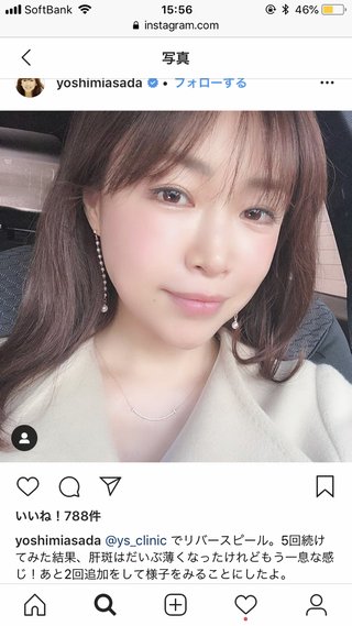 だっちゅーのの浅田好未さん