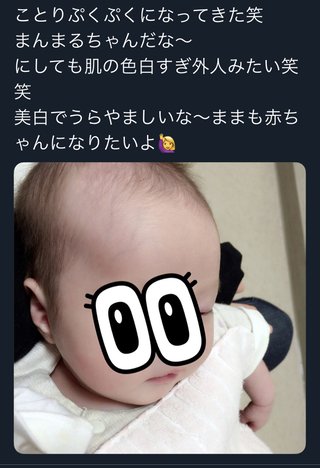 2歳の娘死亡　傷害容疑で母親(21)と交際相手(24)逮捕　体には複数のけが、日常的に虐待か