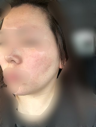 【写見て】顔と首の色の違い