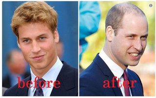 40過ぎても毛量が多いと物凄く若く見える