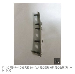 死んだワニの胃袋から人間の整形外科用の金属プレートを発見　ということは…？
