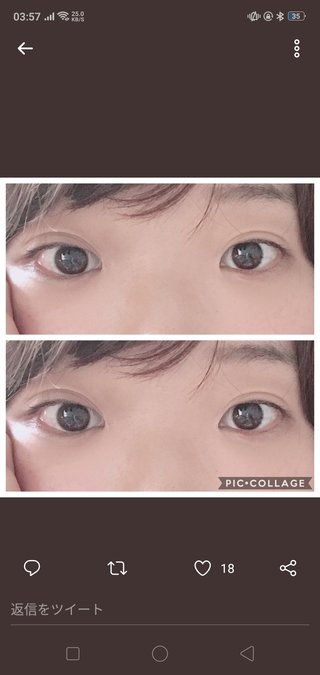 整形女って性格悪くない?整形してその程度