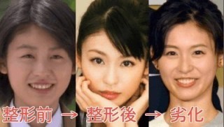 本仮屋ユイカって可愛い系？綺麗系？可愛くて綺麗系？