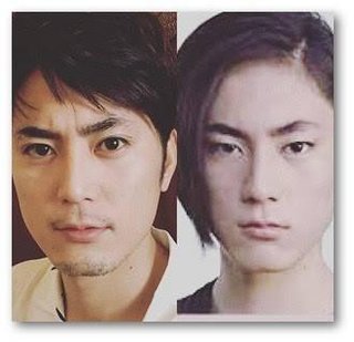 男性芸能人の整形